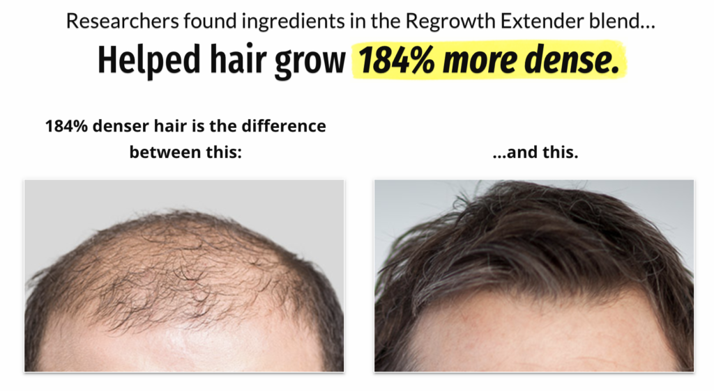Hair Regrowth Extender Blend Results